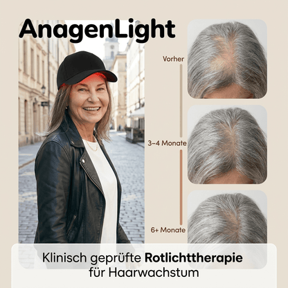 AnagenLight™ – Kontrolliertes Haarwachstum beginnt an der Wurzel. - Zondae