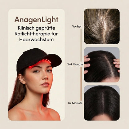 AnagenLight™ – Kontrolliertes Haarwachstum beginnt an der Wurzel. - Zondae