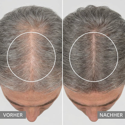AnagenLight™ – Wenn der Spiegel langsam nicht mehr dein Freund ist. - Zondae